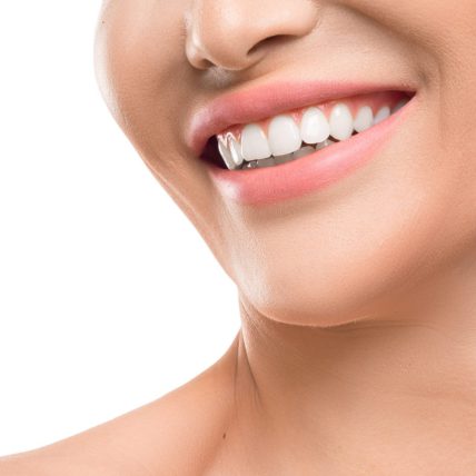 Vrouw met witte rechten tanden